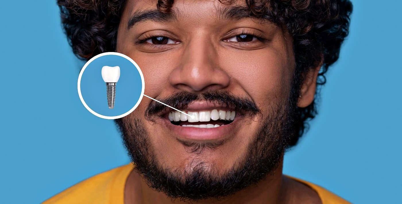 A patient showing off his implant